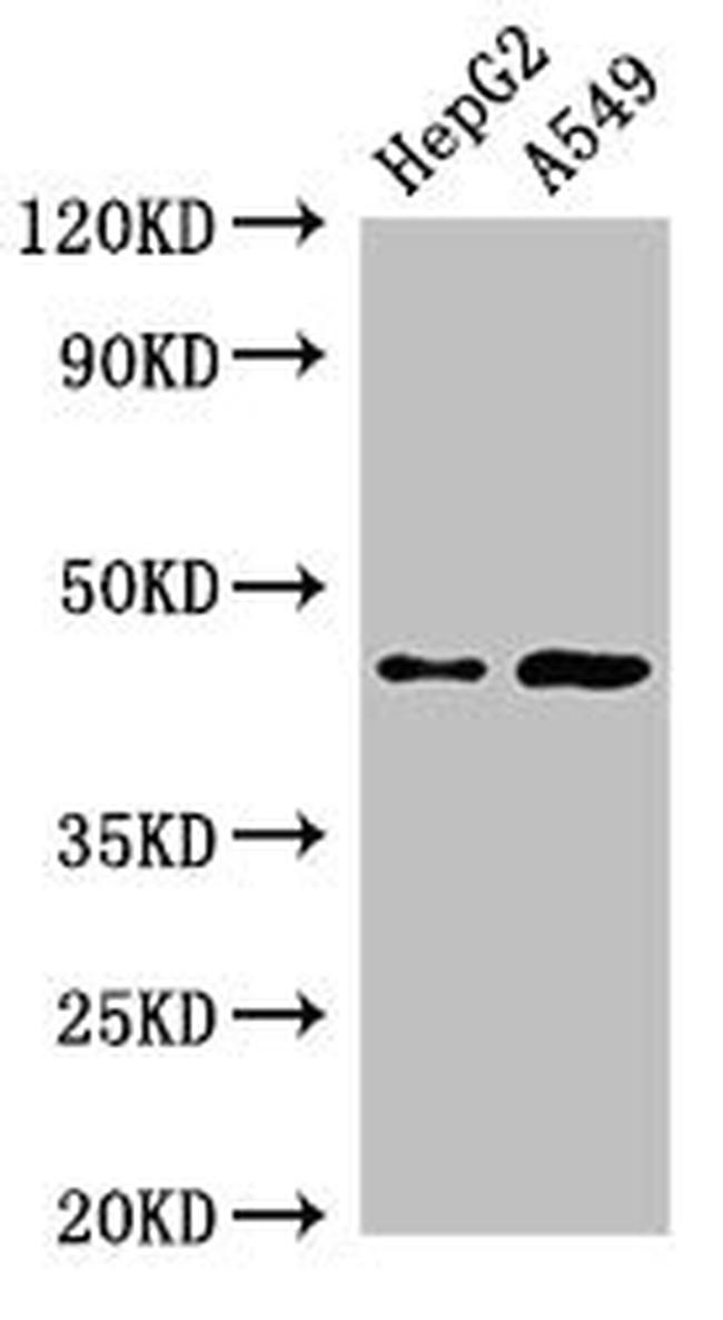 PIGK Antibody in Western Blot (WB)