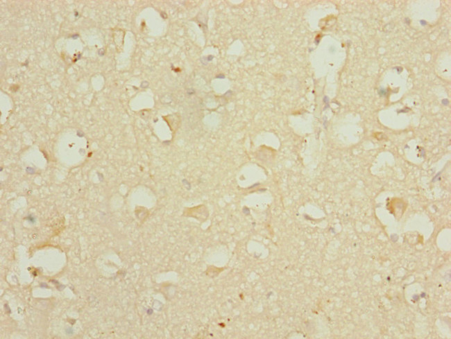 DHTKD1 Antibody in Immunohistochemistry (Paraffin) (IHC (P))