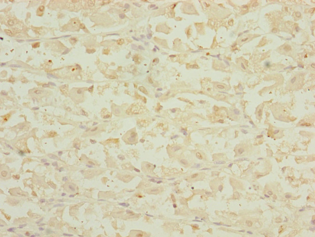 DHTKD1 Antibody in Immunohistochemistry (Paraffin) (IHC (P))