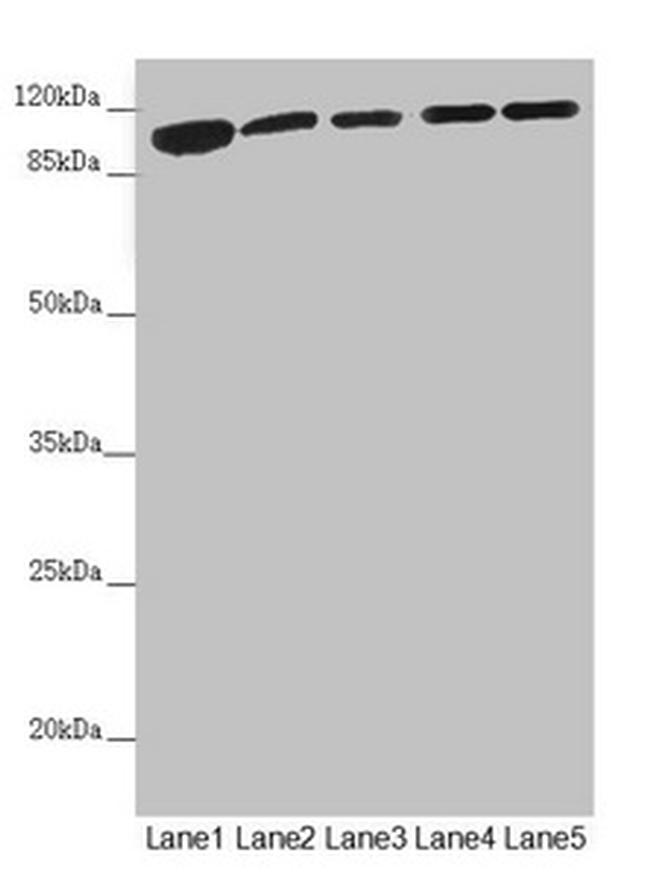 DHTKD1 Antibody in Western Blot (WB)