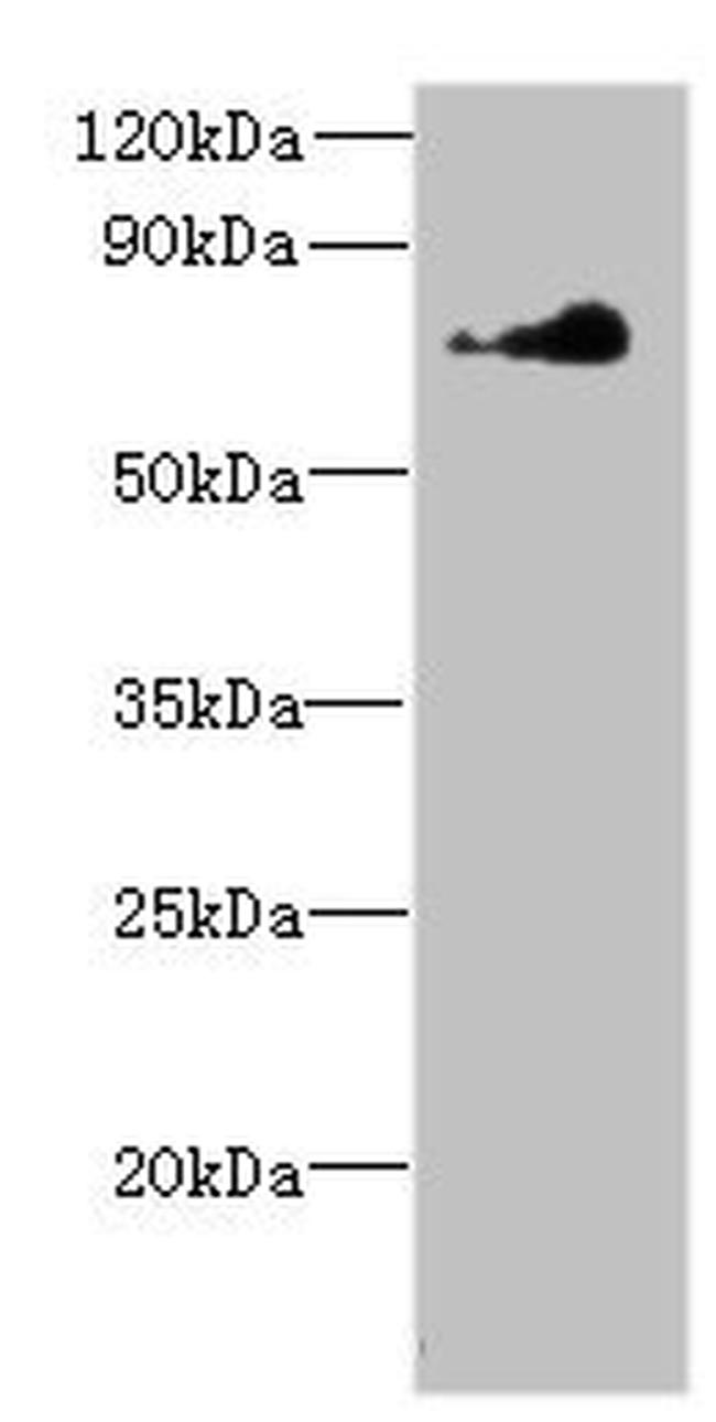 NEK11 Antibody in Western Blot (WB)