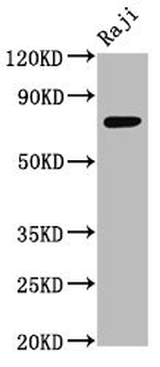 TSPEAR Antibody in Western Blot (WB)