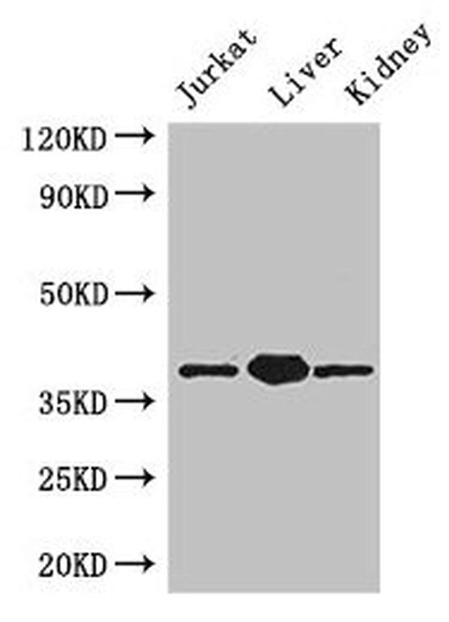 PINX1 Antibody in Western Blot (WB)