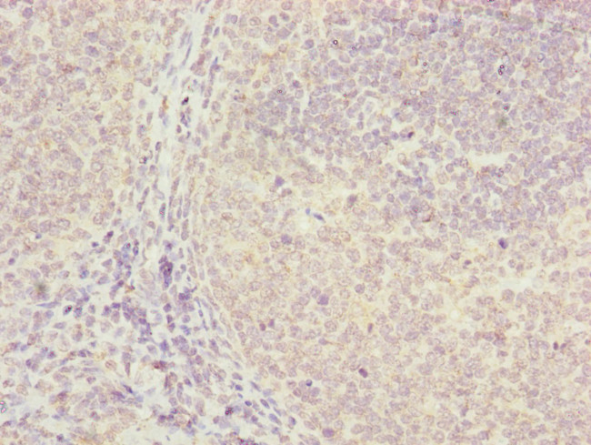 FBXO22 Antibody in Immunohistochemistry (Paraffin) (IHC (P))