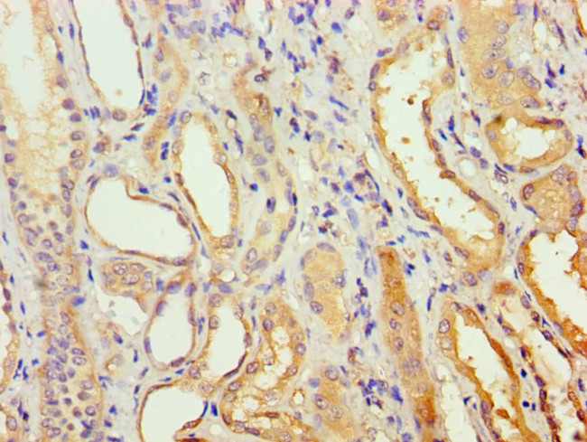 AGPAT1 Antibody in Immunohistochemistry (Paraffin) (IHC (P))