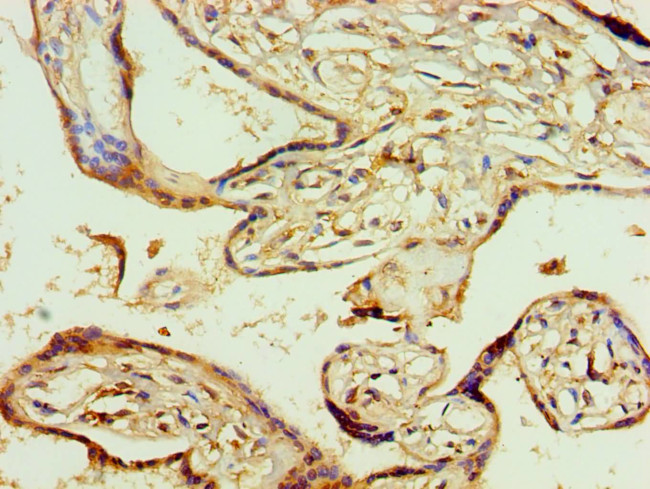 AGPAT1 Antibody in Immunohistochemistry (Paraffin) (IHC (P))