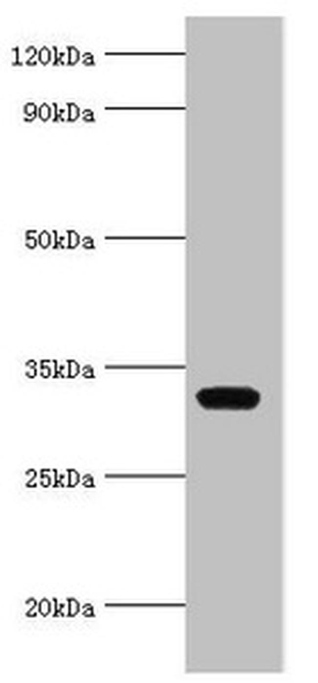 AGPAT1 Antibody in Western Blot (WB)