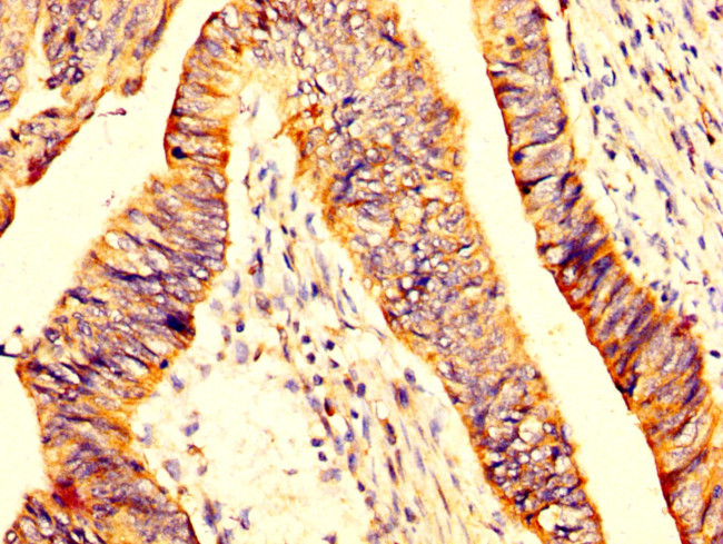 MYOC Antibody in Immunohistochemistry (Paraffin) (IHC (P))