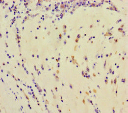 TDRD3 Antibody in Immunohistochemistry (Paraffin) (IHC (P))