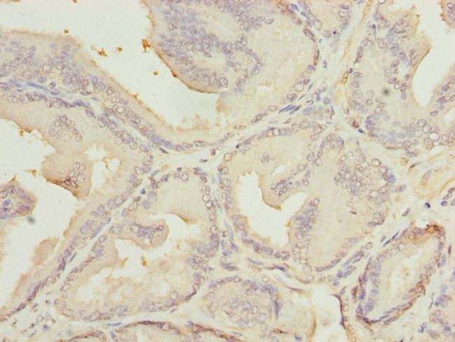 MED18 Antibody in Immunohistochemistry (Paraffin) (IHC (P))