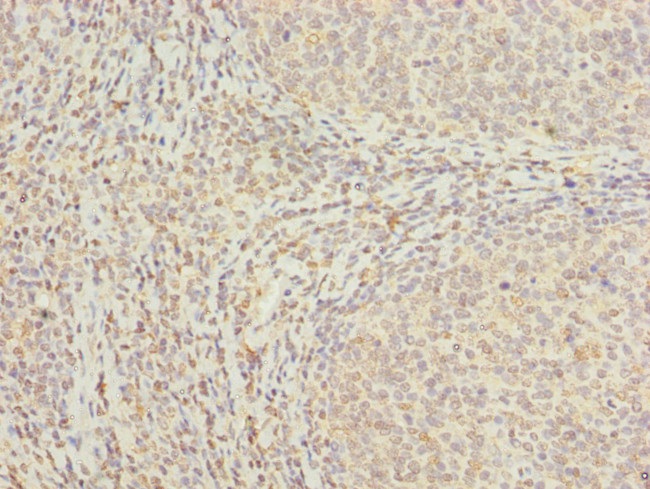 MED18 Antibody in Immunohistochemistry (Paraffin) (IHC (P))