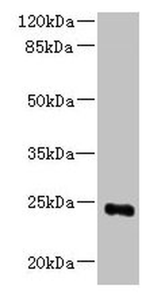 MED18 Antibody in Western Blot (WB)