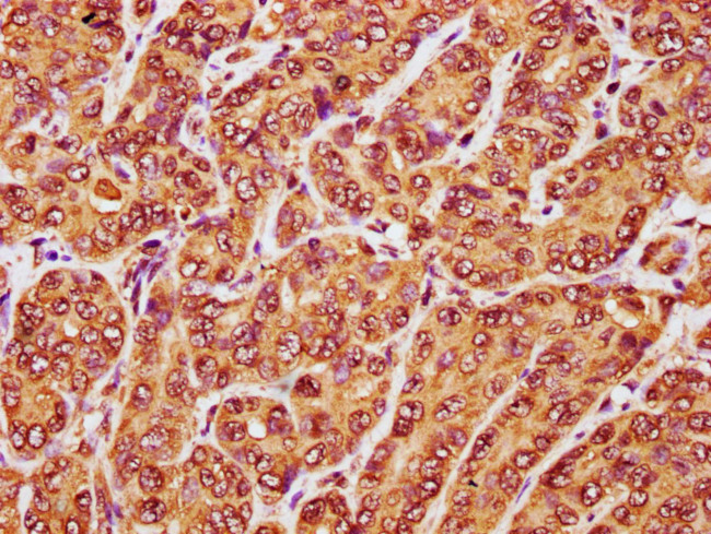 RANBP17 Antibody in Immunohistochemistry (Paraffin) (IHC (P))