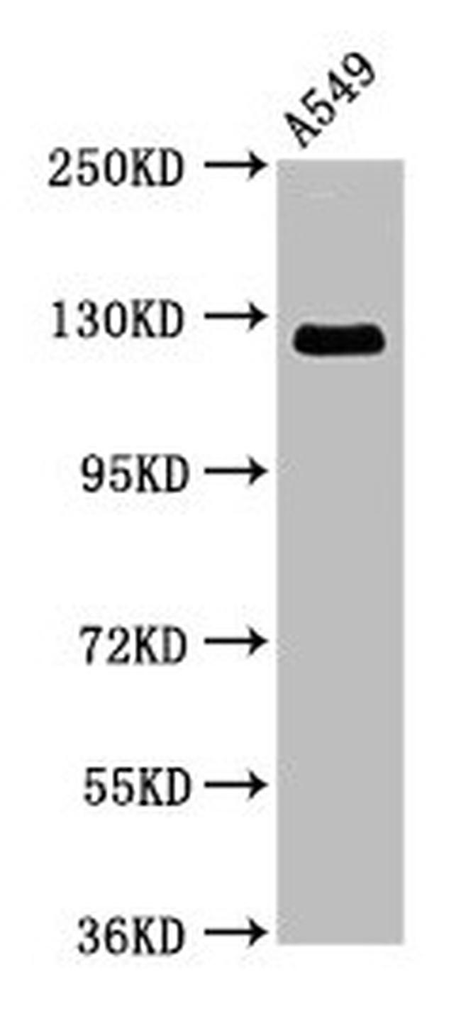 RANBP17 Antibody in Western Blot (WB)