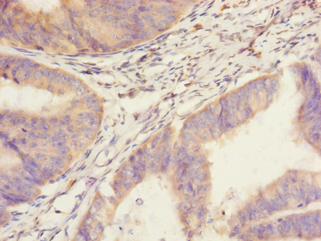 SAV1 Antibody in Immunohistochemistry (Paraffin) (IHC (P))