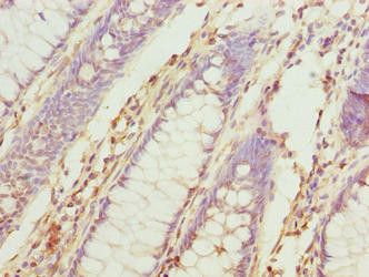 TUBB6 Antibody in Immunohistochemistry (Paraffin) (IHC (P))