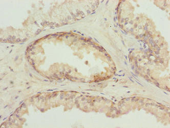 TUBB6 Antibody in Immunohistochemistry (Paraffin) (IHC (P))