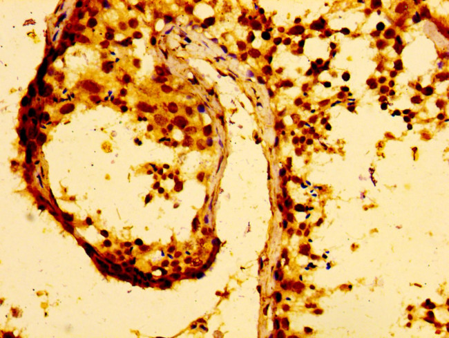 MMP28 Antibody in Immunohistochemistry (Paraffin) (IHC (P))