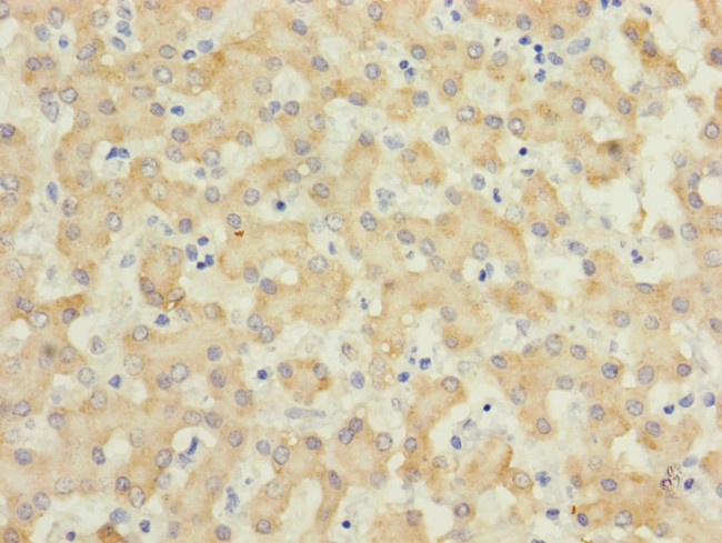 IL17RB Antibody in Immunohistochemistry (Paraffin) (IHC (P))