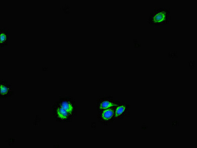 UVRAG Antibody in Immunocytochemistry (ICC/IF)