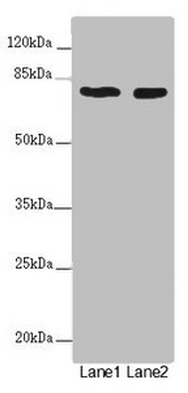 UVRAG Antibody in Western Blot (WB)