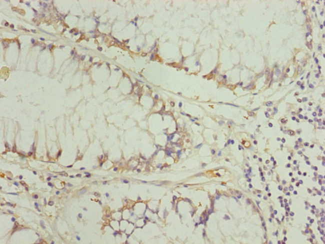 TRIM31 Antibody in Immunohistochemistry (Paraffin) (IHC (P))