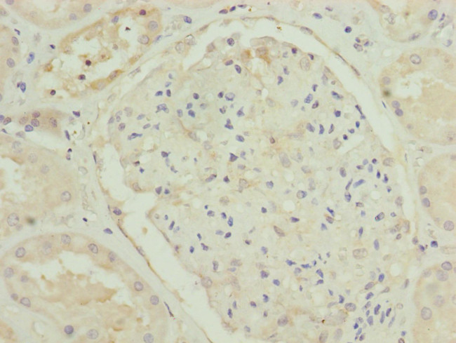 TRIM31 Antibody in Immunohistochemistry (Paraffin) (IHC (P))