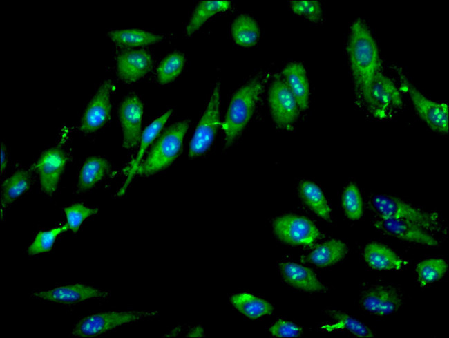 GTPBP4 Antibody in Immunocytochemistry (ICC/IF)