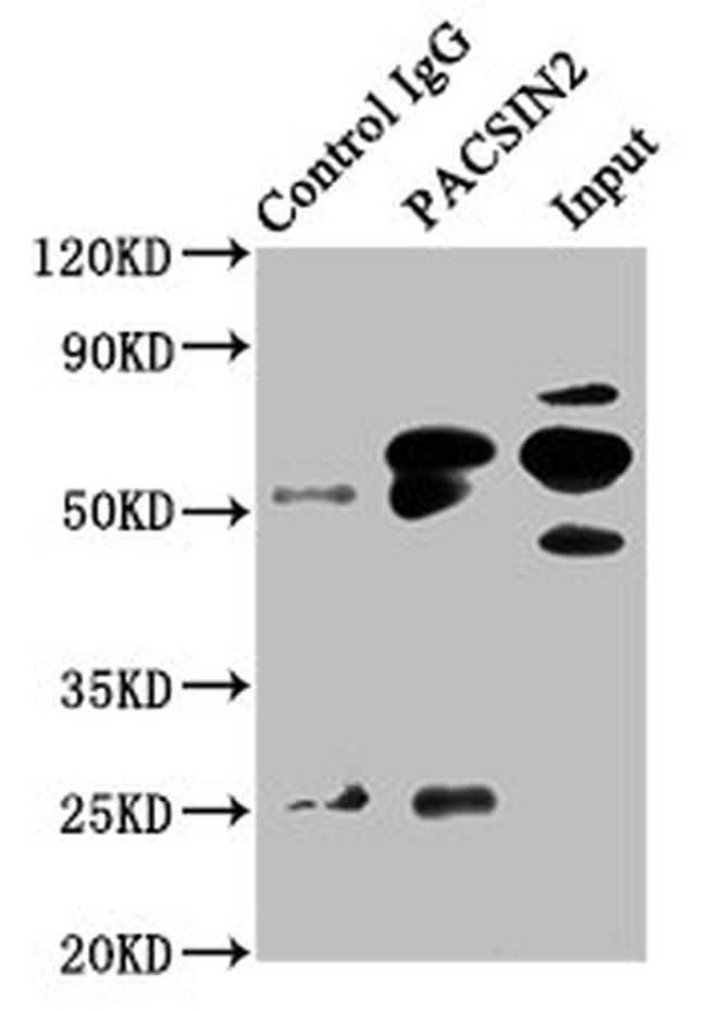 PACSIN2 Antibody in Western Blot (WB)