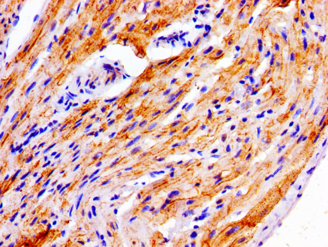 NDRG4 Antibody in Immunohistochemistry (Paraffin) (IHC (P))