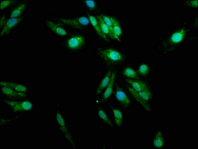 PADI2 Antibody in Immunocytochemistry (ICC/IF)