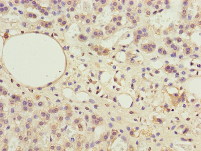 PPP2R3B Antibody in Immunohistochemistry (Paraffin) (IHC (P))