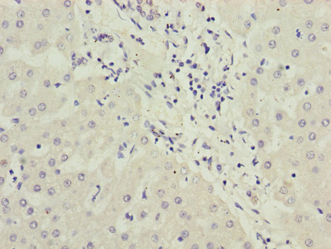 PPP2R3B Antibody in Immunohistochemistry (Paraffin) (IHC (P))