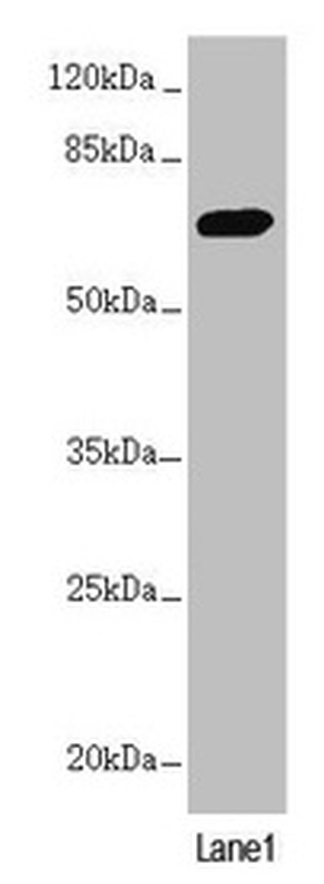 PPP2R3B Antibody in Western Blot (WB)