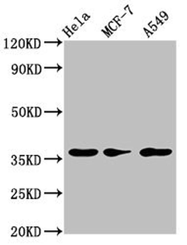RCE1 Antibody in Western Blot (WB)