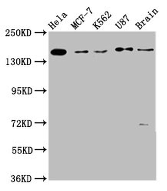 RAD54L2 Antibody in Western Blot (WB)