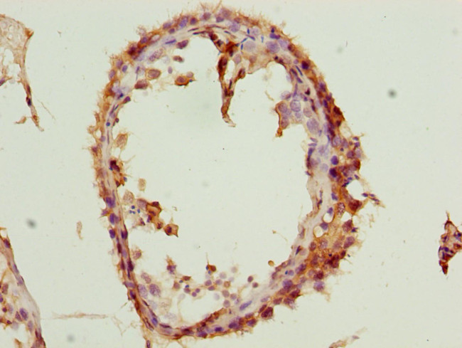 SPIN1 Antibody in Immunohistochemistry (Paraffin) (IHC (P))