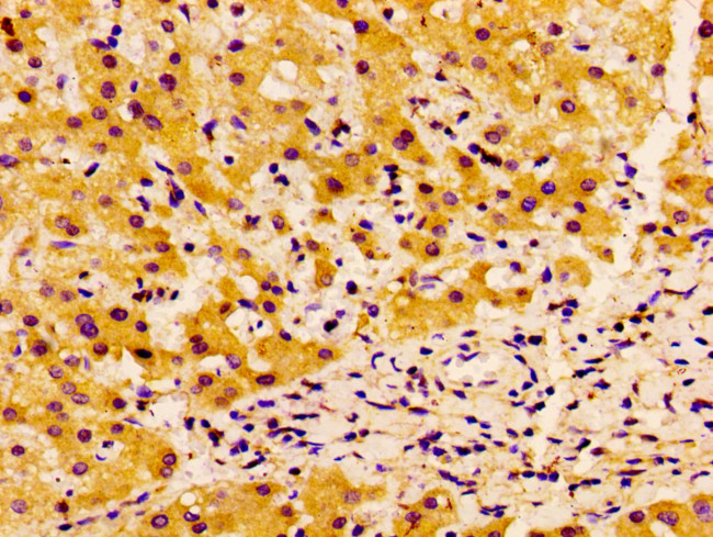 SSX2IP Antibody in Immunohistochemistry (Paraffin) (IHC (P))