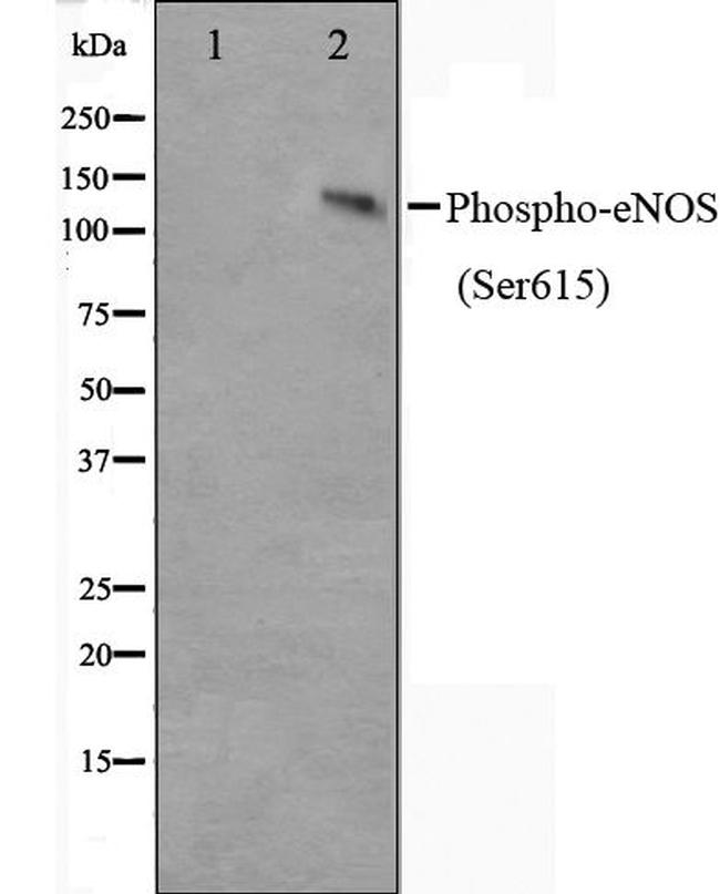 Phospho-eNOS (Ser615) Antibody in Western Blot (WB)