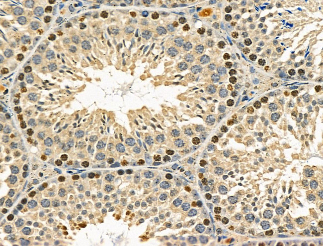 Phospho-FANCG (Ser383) Antibody in Immunohistochemistry (Paraffin) (IHC (P))