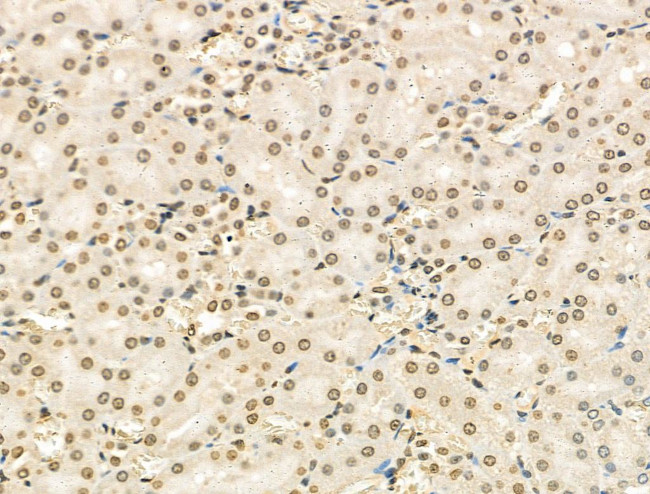 Phospho-FANCG (Ser383) Antibody in Immunohistochemistry (Paraffin) (IHC (P))