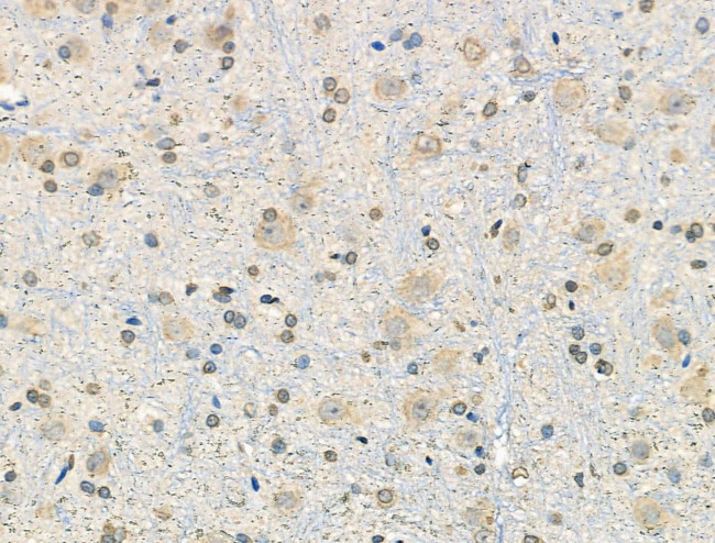 Phospho-FANCG (Ser383) Antibody in Immunohistochemistry (Paraffin) (IHC (P))