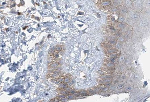 TTK Antibody in Immunohistochemistry (Paraffin) (IHC (P))