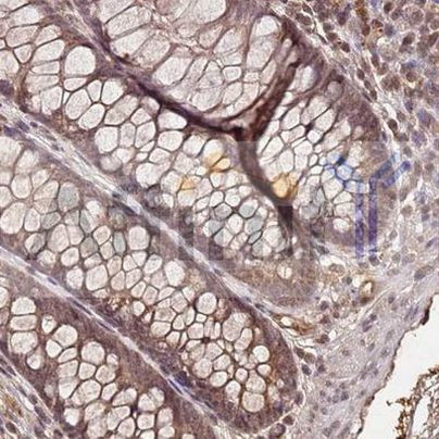 Collagen II Antibody in Immunohistochemistry (Paraffin) (IHC (P))