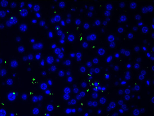 Collagen II Antibody in Immunohistochemistry (Paraffin) (IHC (P))