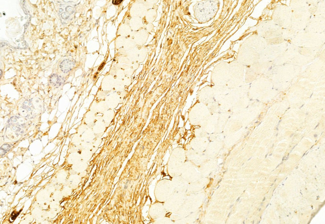 Collagen III Antibody in Immunohistochemistry (Paraffin) (IHC (P))