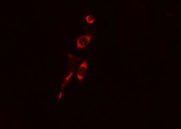 Collagen III Antibody in Immunocytochemistry (ICC/IF)