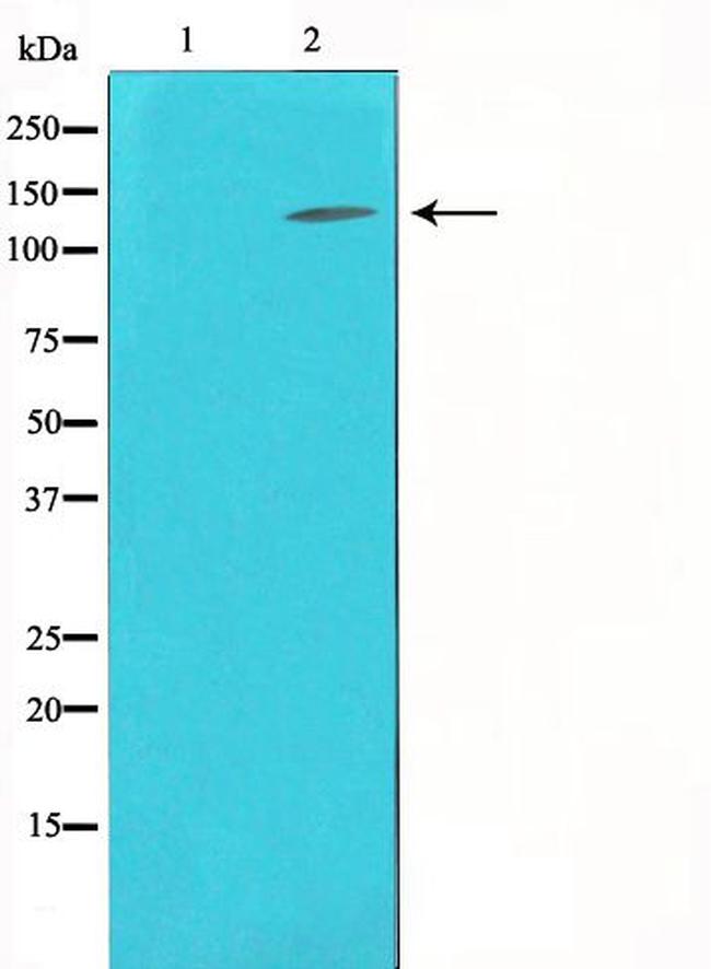 Collagen III Antibody in Western Blot (WB)