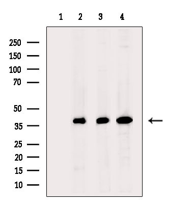DNA Polymerase beta Antibody in Western Blot (WB)