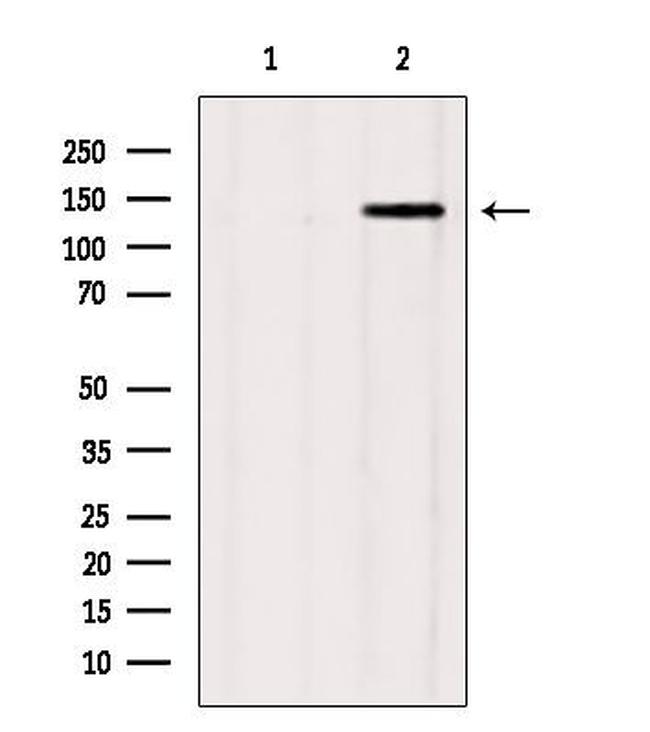 GAK Antibody in Western Blot (WB)